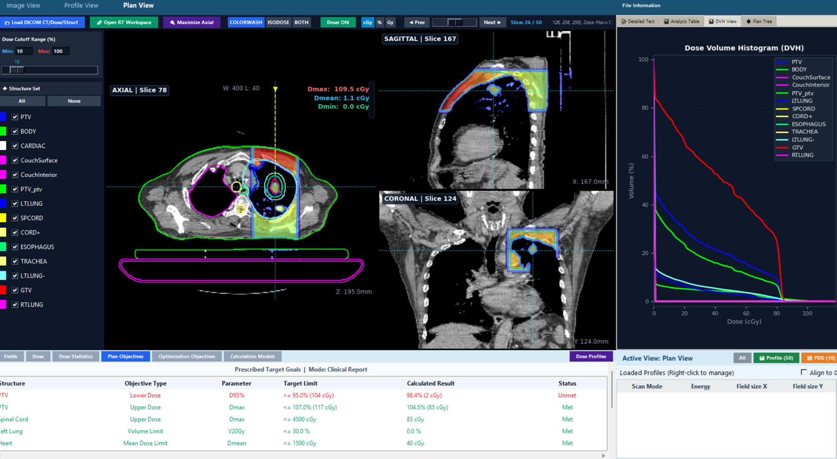 Plan View Screen